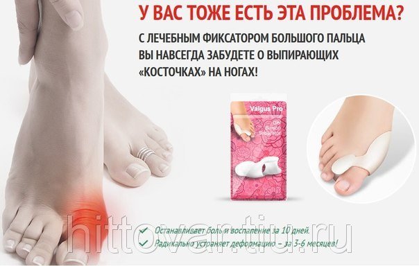 Средство Valgus pro вылечит косточку на ноге просто и быстро 49510146