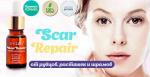 Средство Scar Repair от рубцов растяжек и шрамов 54398845