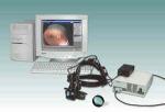 Офтальмоскоп с видеосистемой