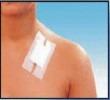 Пластырь на шелковой основе Дюрапор (Durapore™). 1,25 см х 9,1 м. Пластырь на шелковой основе Дюрапор (Durapore™). 1,25 см х 9,1 м.