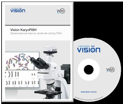 Программное обеспечение для хромосомного анализа, включая метод FISH Vision KaryoFISH Программное обеспечение для хромосомного анализа, включая метод FISH Vision KaryoFISH